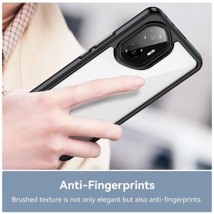 For Honor 300 Colorful Series Acrylic Hybrid TPU Phone Case
