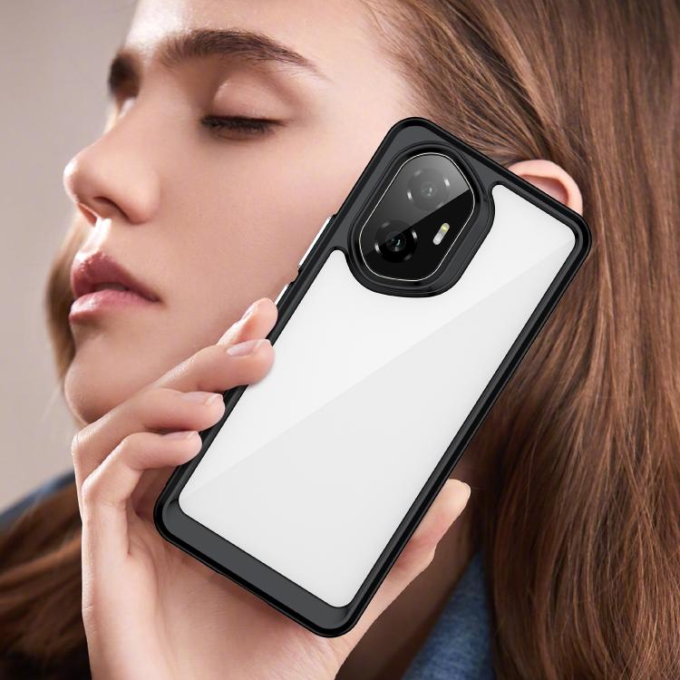 For Honor 300 Colorful Series Acrylic Hybrid TPU Phone Case