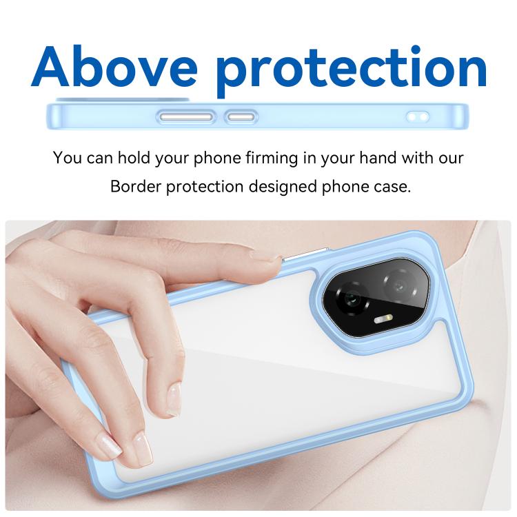 For Honor 300 Colorful Series Acrylic Hybrid TPU Phone Case