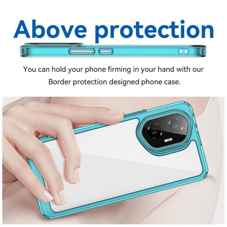 For Honor 300 Colorful Series Acrylic Hybrid TPU Phone Case