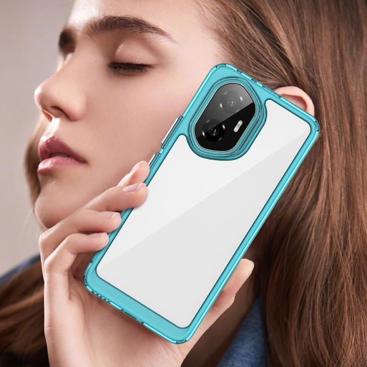 For Honor 300 Colorful Series Acrylic Hybrid TPU Phone Case