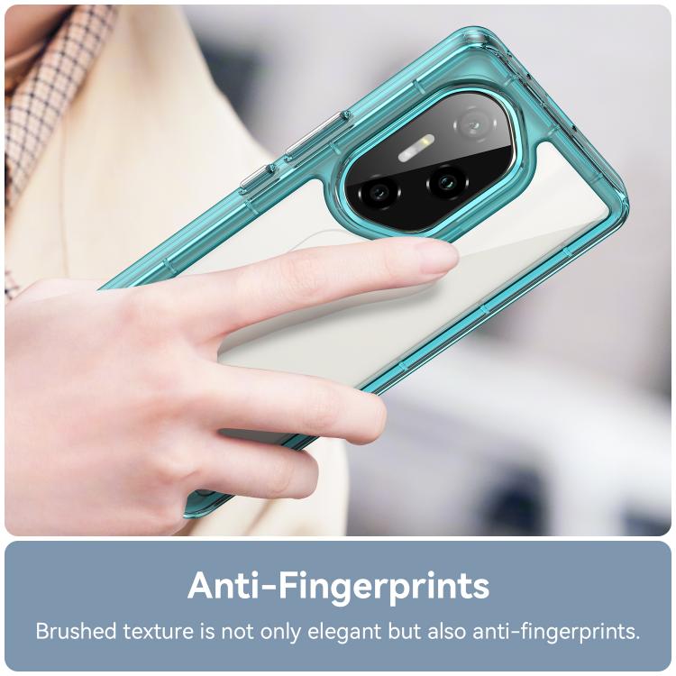 For Honor 300 Ultra Colorful Series Acrylic Hybrid TPU Phone Case