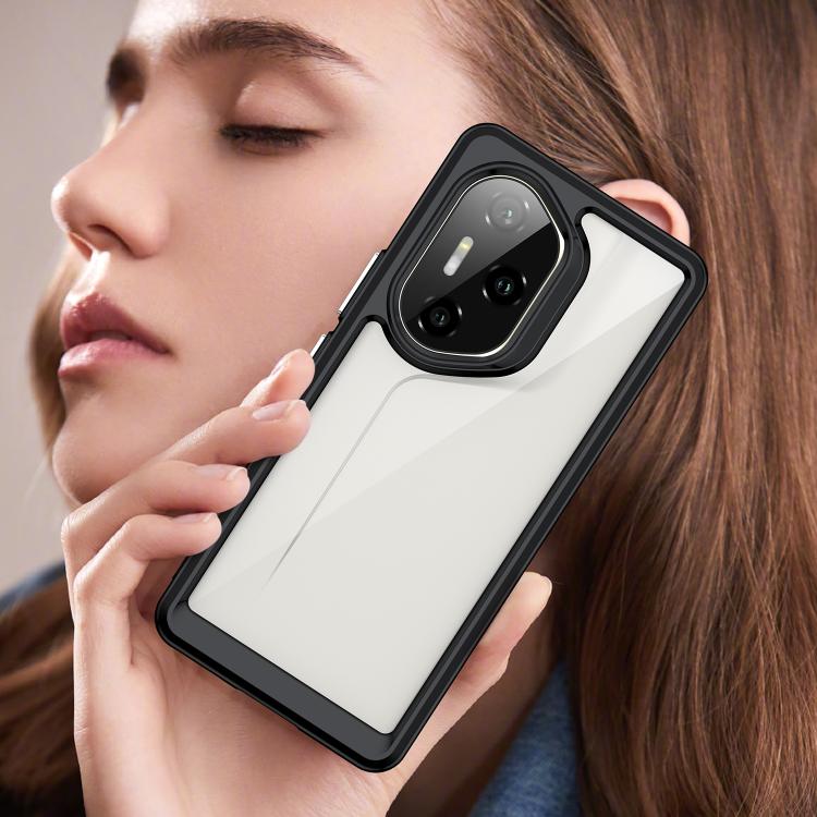 For Honor 300 Pro Colorful Series Acrylic Hybrid TPU Phone Case
