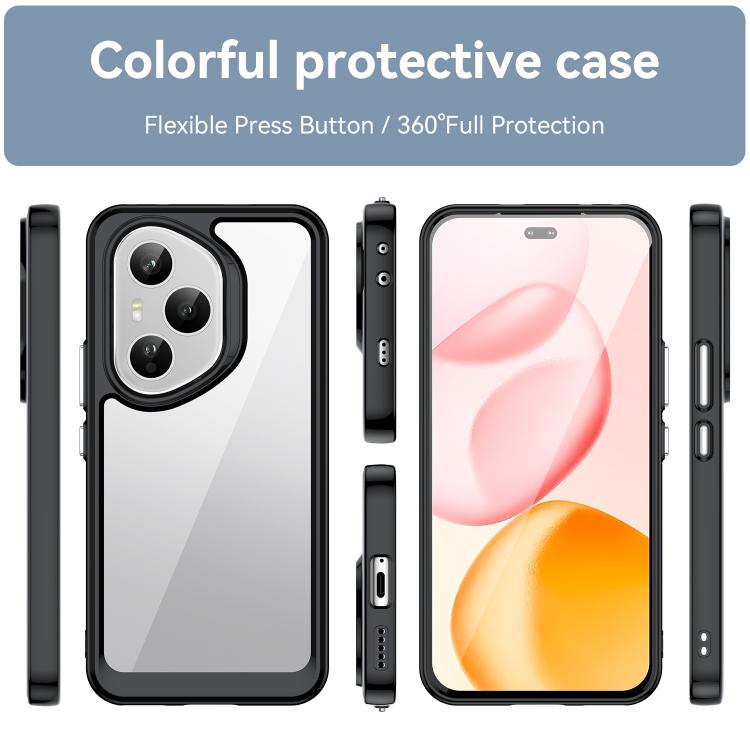For Honor 400 Pro 5G Global 160.8mm Colorful Series Acrylic Hybrid TPU Phone Case