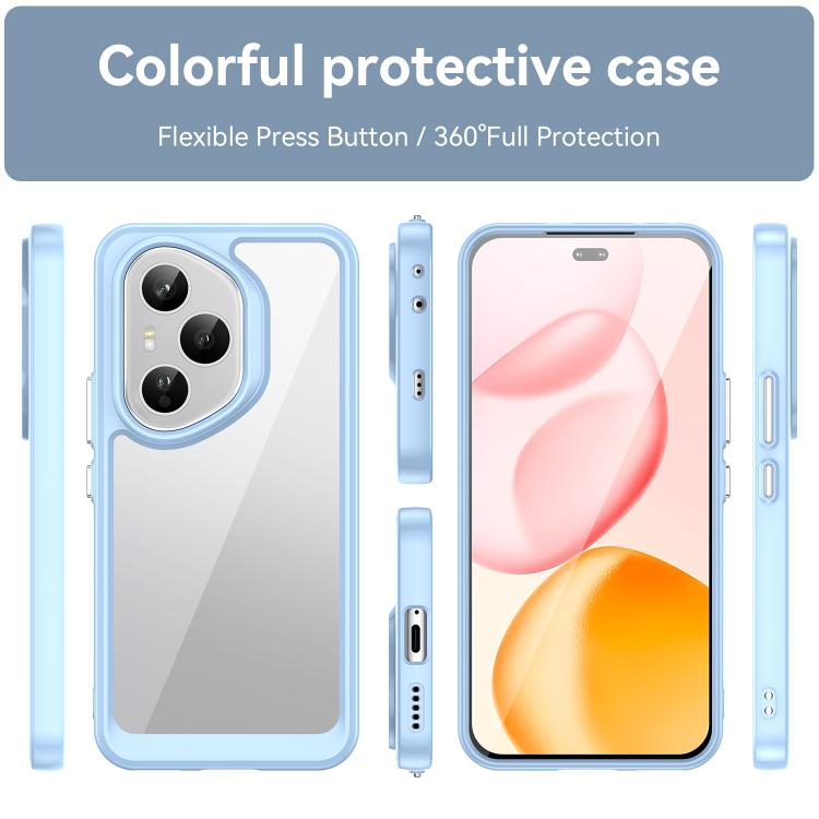 For Honor 400 Pro 5G Global 160.8mm Colorful Series Acrylic Hybrid TPU Phone Case