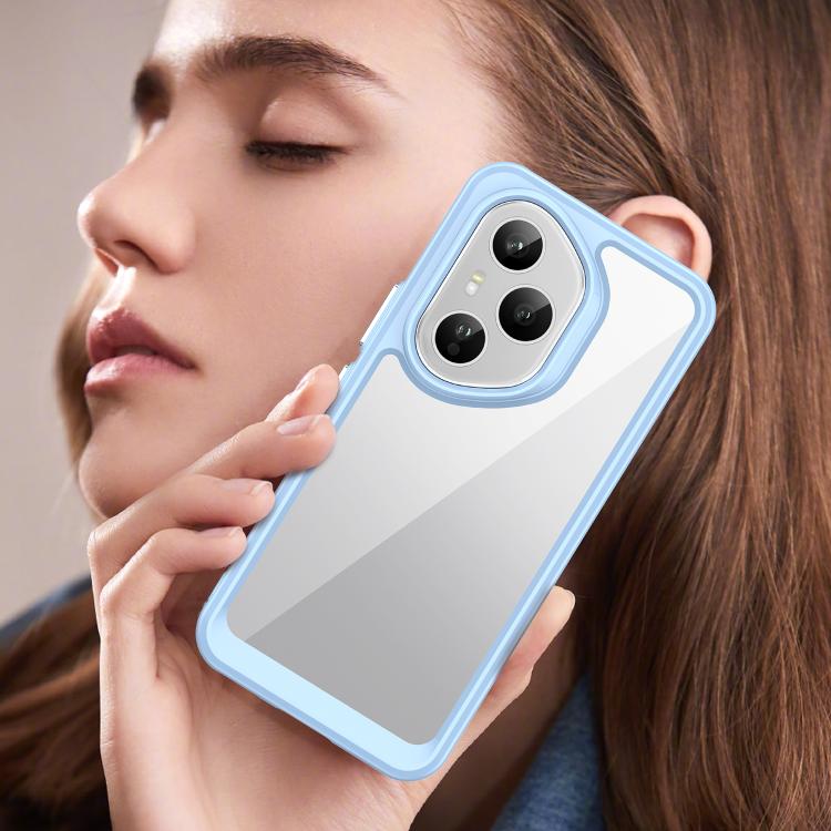 For Honor 400 Pro 5G Global 160.8mm Colorful Series Acrylic Hybrid TPU Phone Case