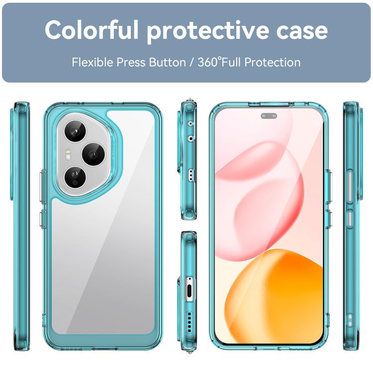 For Honor 400 Pro 5G Global 160.8mm Colorful Series Acrylic Hybrid TPU Phone Case