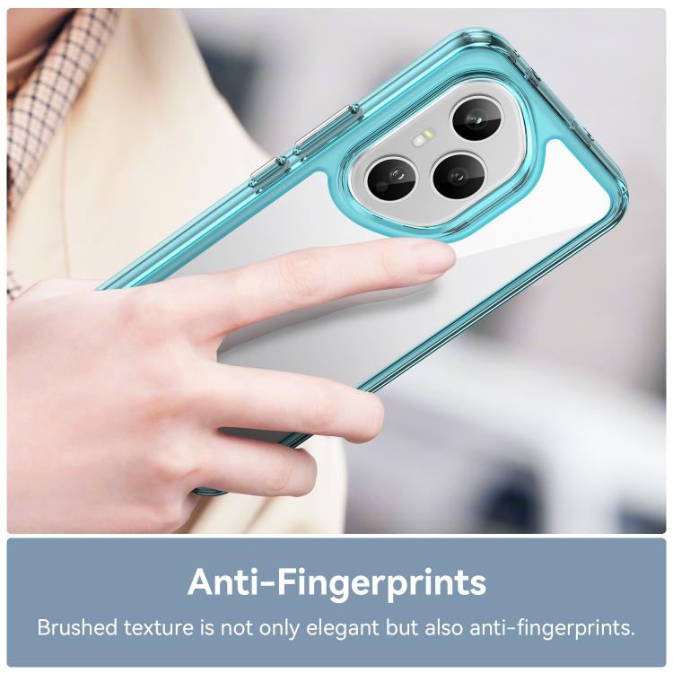 For Honor 400 Pro 5G Global 160.8mm Colorful Series Acrylic Hybrid TPU Phone Case