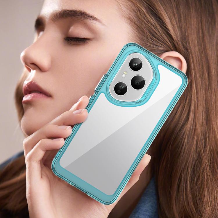 For Honor 400 Pro 5G Global 160.8mm Colorful Series Acrylic Hybrid TPU Phone Case