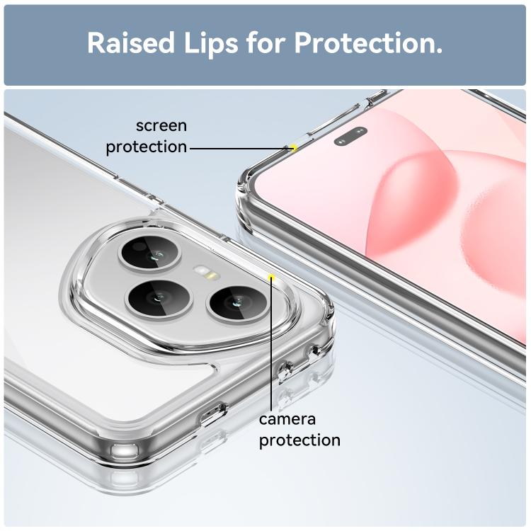 For Honor 400 Pro 5G Global 160.8mm Colorful Series Acrylic Hybrid TPU Phone Case