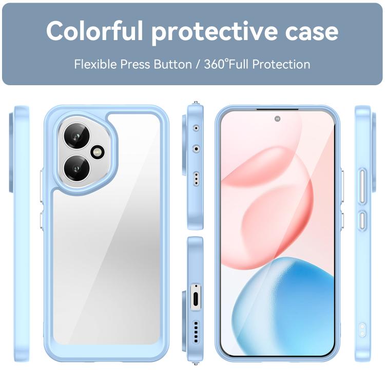 For Honor 400 Global 156.5mm Colorful Series Acrylic Hybrid TPU Phone Case
