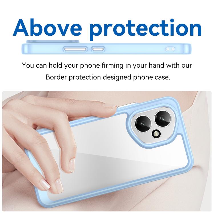 For Honor 400 Global 156.5mm Colorful Series Acrylic Hybrid TPU Phone Case