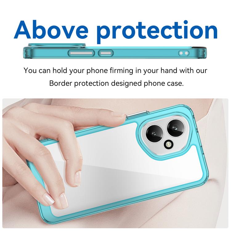 For Honor 400 Global 156.5mm Colorful Series Acrylic Hybrid TPU Phone Case