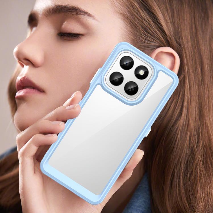 For Honor 400 Smart 5G Colorful Series Acrylic Hybrid TPU Phone Case