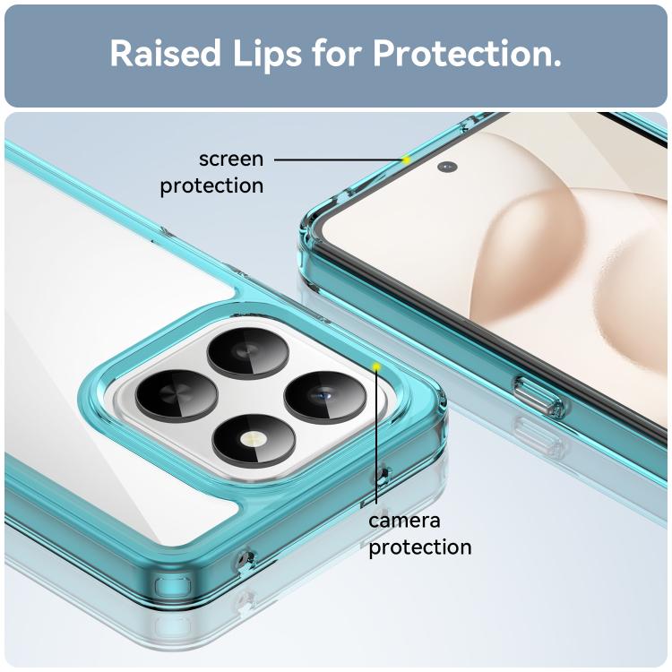 For Honor 400 Smart 5G Colorful Series Acrylic Hybrid TPU Phone Case