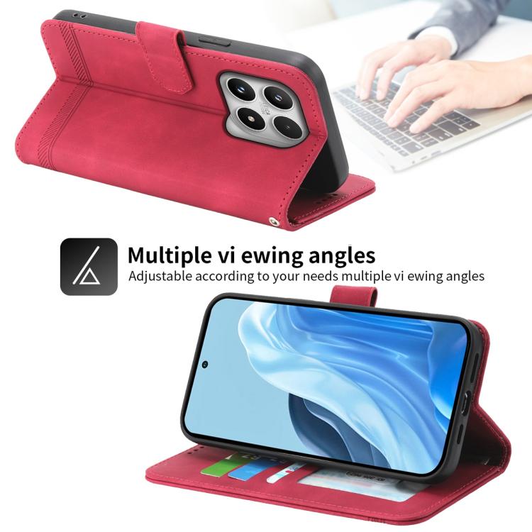 For Xiaomi 17 Dierfeng Dream Line TPU Hybrid PU Leather Phone Case
