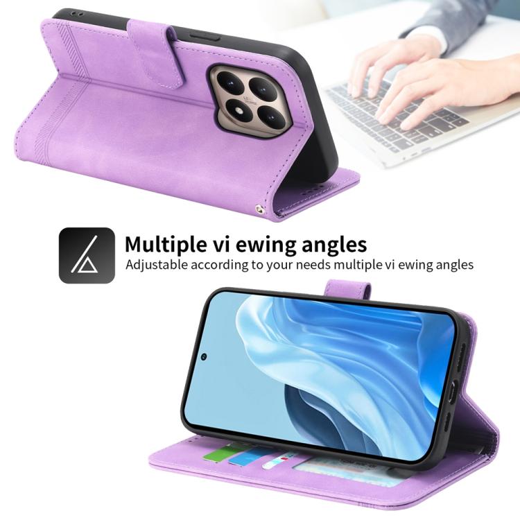 For Xiaomi 15T 5G Dierfeng Dream Line TPU Hybrid PU Leather Phone Case