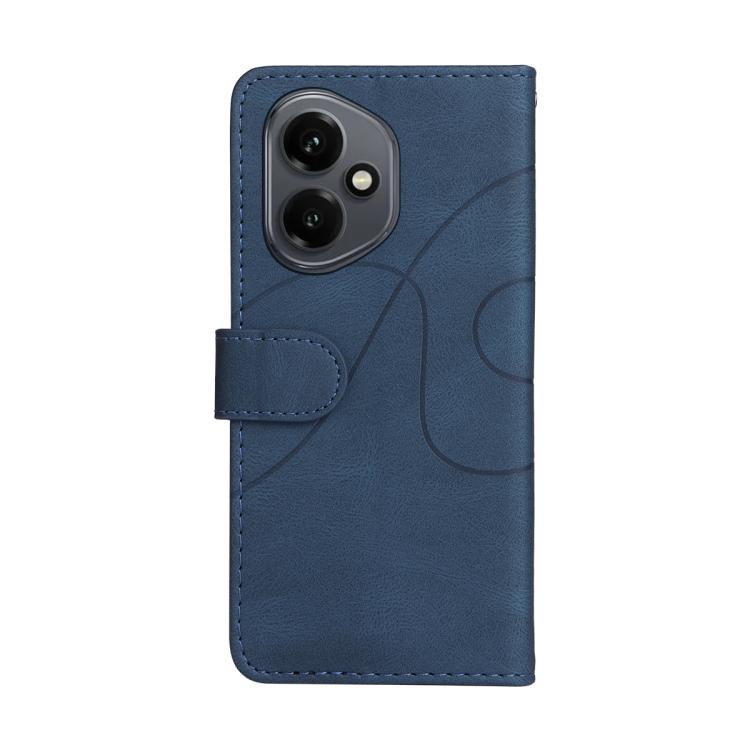 For Honor 400 Global 156.5mm Dual-color Splicing Flip Leather Phone Case