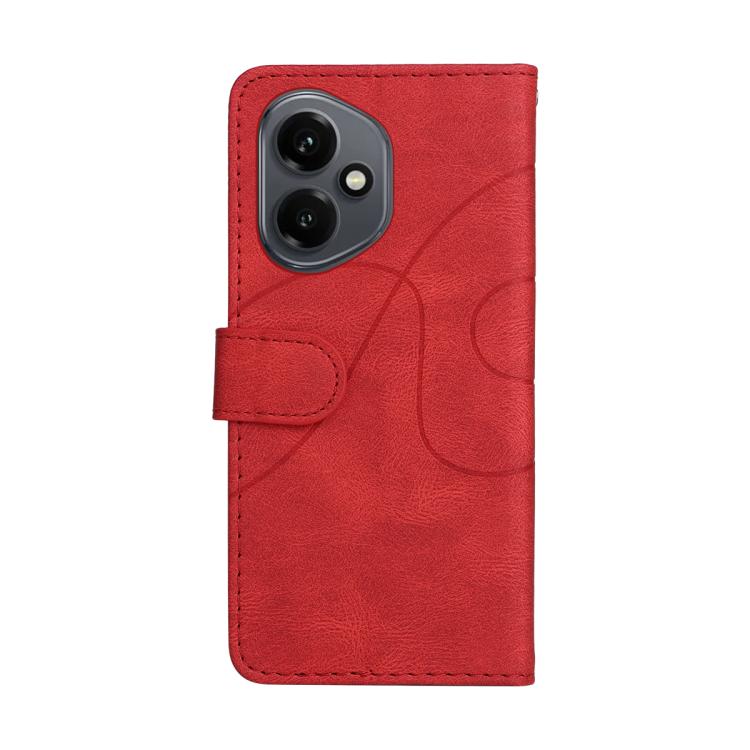 For Honor 400 Global 156.5mm Dual-color Splicing Flip Leather Phone Case