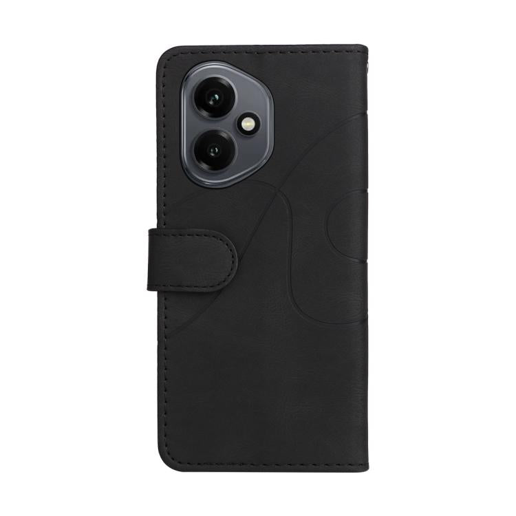 For Honor 400 Global 156.5mm Dual-color Splicing Flip Leather Phone Case
