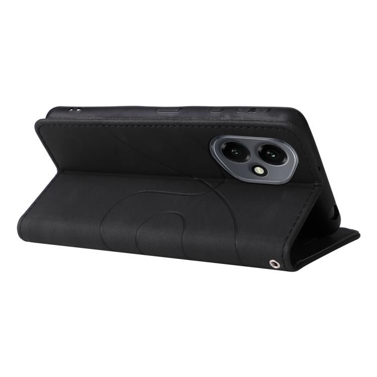 For Honor 400 Global 156.5mm Dual-color Splicing Flip Leather Phone Case