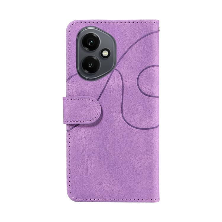 For Honor 400 Global 156.5mm Dual-color Splicing Flip Leather Phone Case