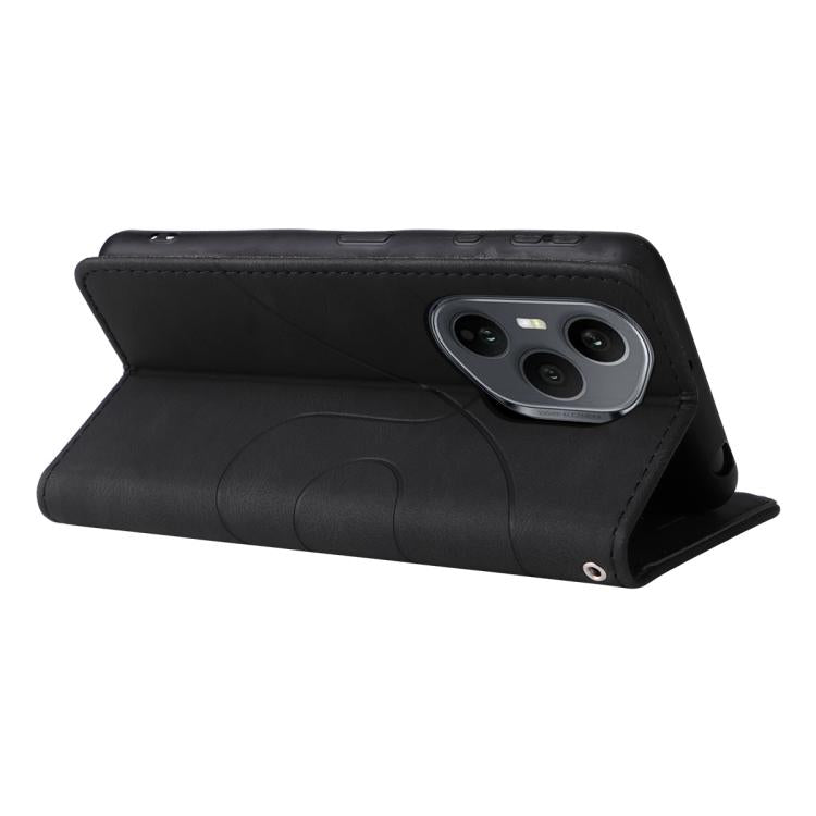 For Honor 400 Pro Global 160.8mm Dual-color Splicing Flip Leather Phone Case