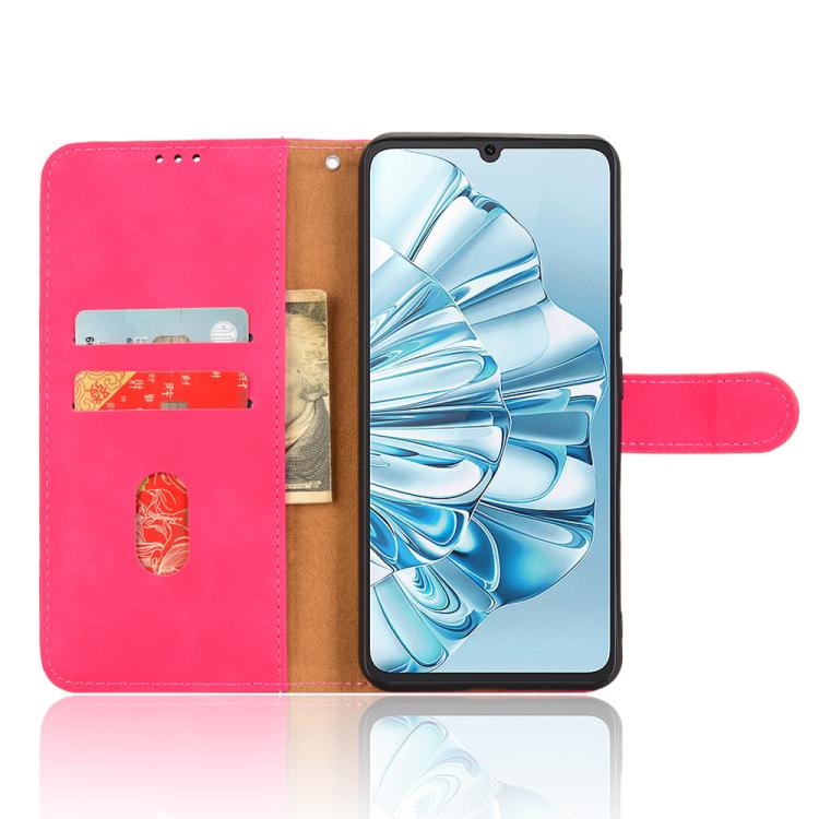 For Cubot A20 Skin Feel Magnetic Flip Leather Phone Case