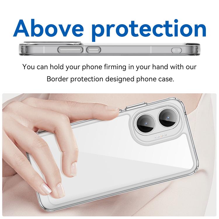 For Redmi Turbo 4 Pro Colorful Series Acrylic Hybrid TPU Phone Case