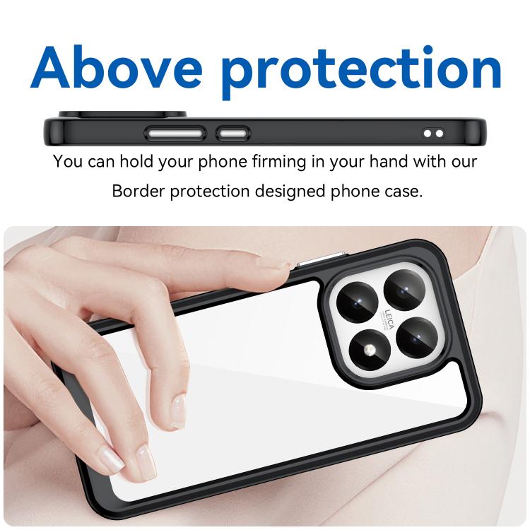 For Xiaomi 15T 5G Colorful Series Acrylic Hybrid TPU Phone Case