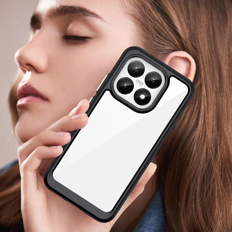 For Xiaomi 15T 5G Colorful Series Acrylic Hybrid TPU Phone Case