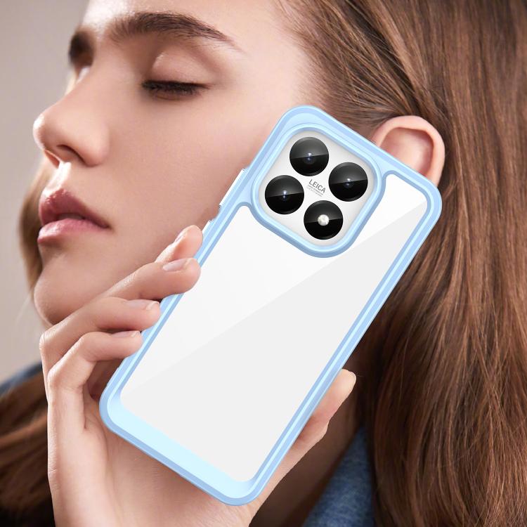 For Xiaomi 15T 5G Colorful Series Acrylic Hybrid TPU Phone Case