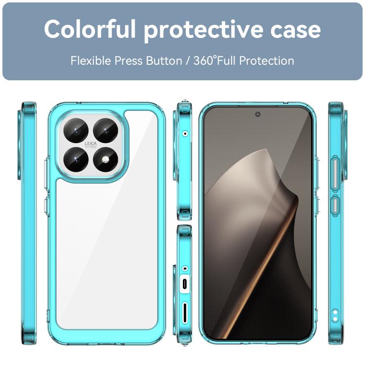 For Xiaomi 15T 5G Colorful Series Acrylic Hybrid TPU Phone Case