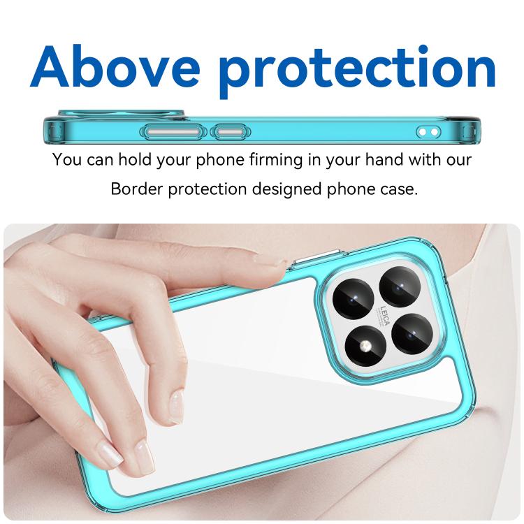For Xiaomi 15T 5G Colorful Series Acrylic Hybrid TPU Phone Case