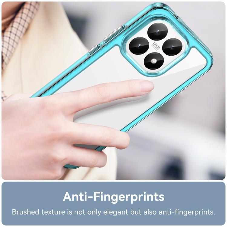 For Xiaomi 15T 5G Colorful Series Acrylic Hybrid TPU Phone Case