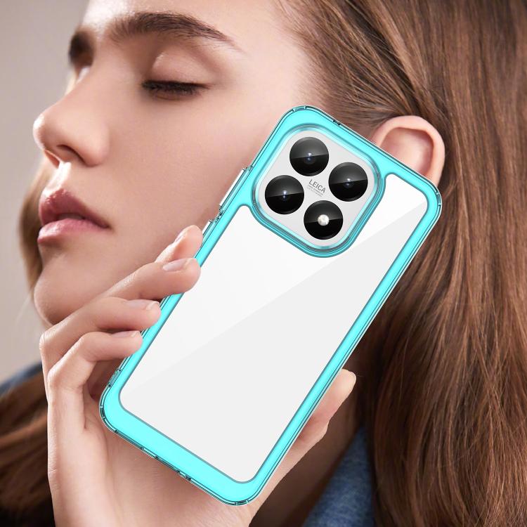 For Xiaomi 15T 5G Colorful Series Acrylic Hybrid TPU Phone Case