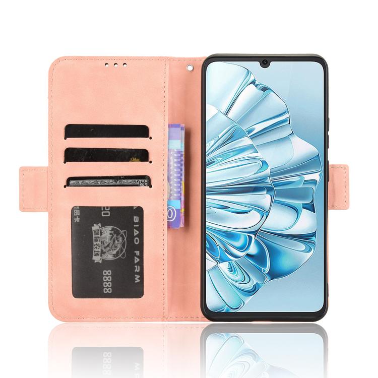 For Cubot A20 Skin Feel Calf Texture Card Slots Leather Phone Case