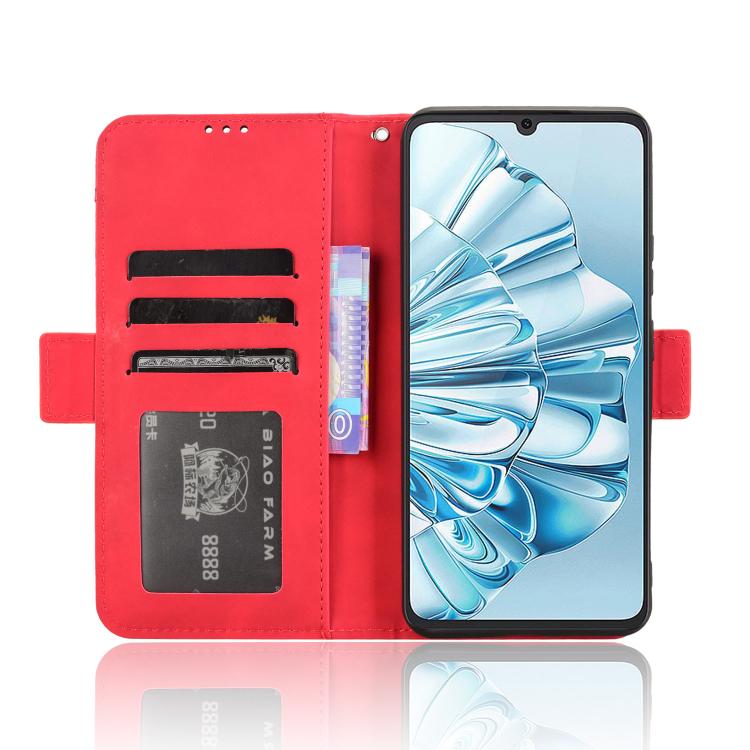 For Cubot A20 Skin Feel Calf Texture Card Slots Leather Phone Case