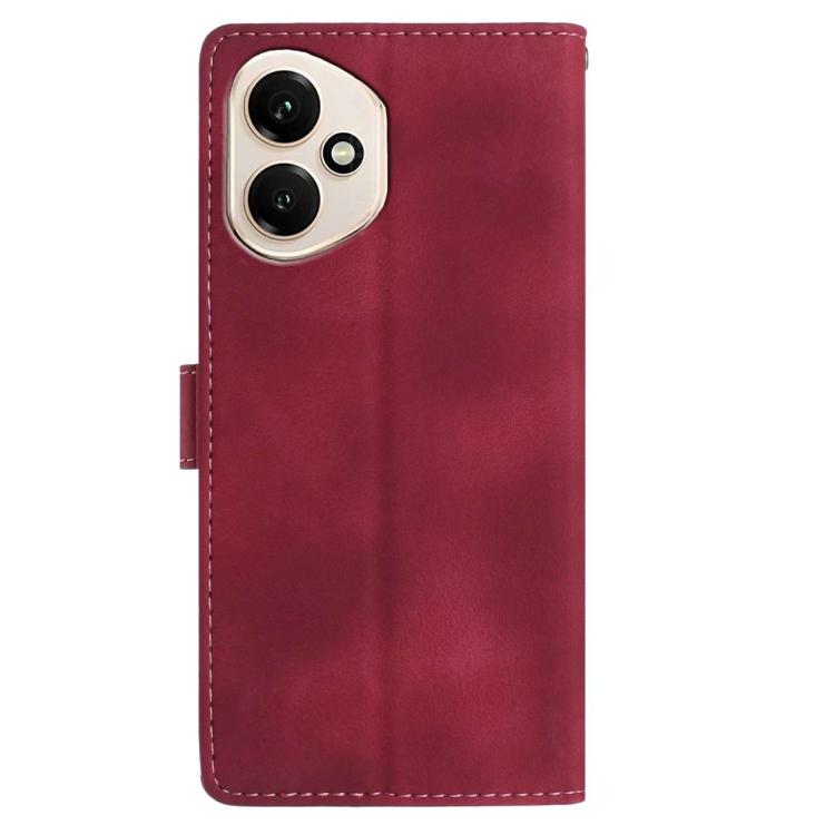For Honor 400 Global 156.5mm Skin Feel Embossed Feather Leather Phone Case