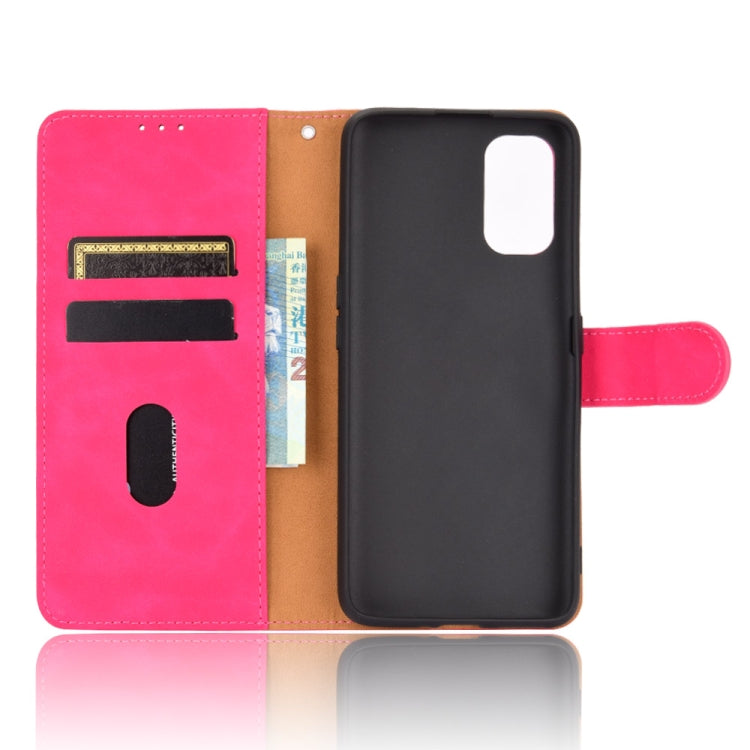 For OPPO Realme X7 Solid Color Skin Feel Magnetic Buckle Horizontal Flip Calf Texture PU Leather Case with Holder & Card Slots & Wallet