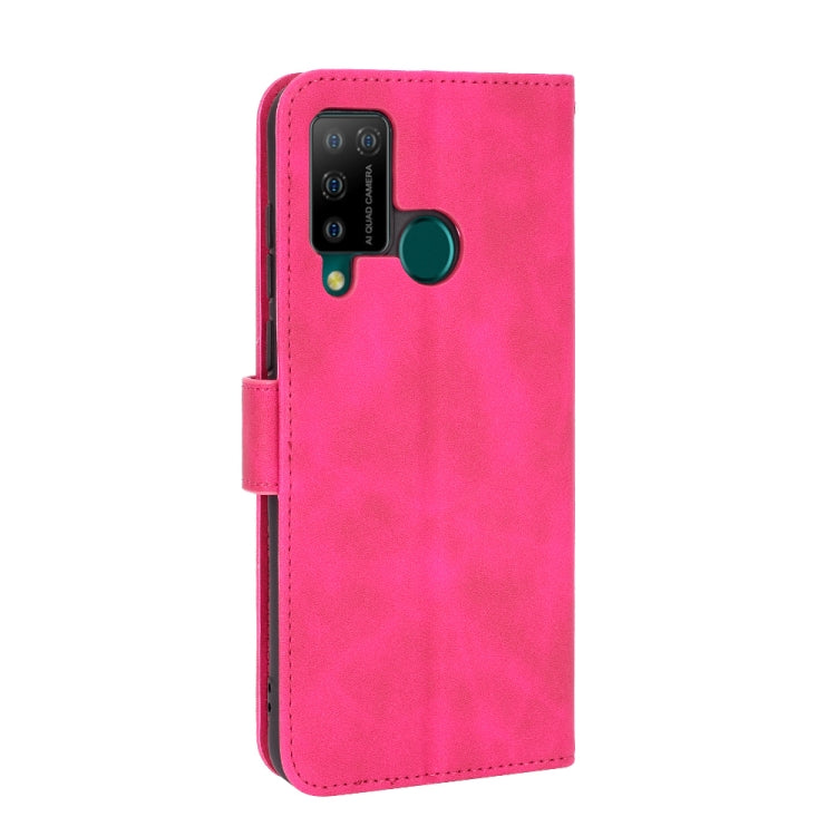 For DOOGEE N20 Pro Solid Color Skin Feel Magnetic Buckle Horizontal Flip Calf Texture PU Leather Case with Holder & Card Slots & Wallet