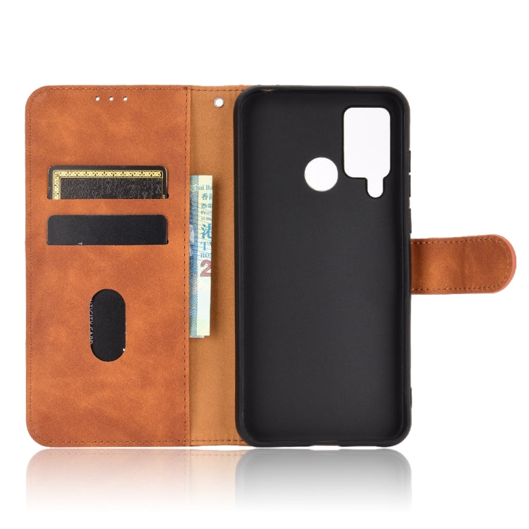 For DOOGEE N20 Pro Solid Color Skin Feel Magnetic Buckle Horizontal Flip Calf Texture PU Leather Case with Holder & Card Slots & Wallet