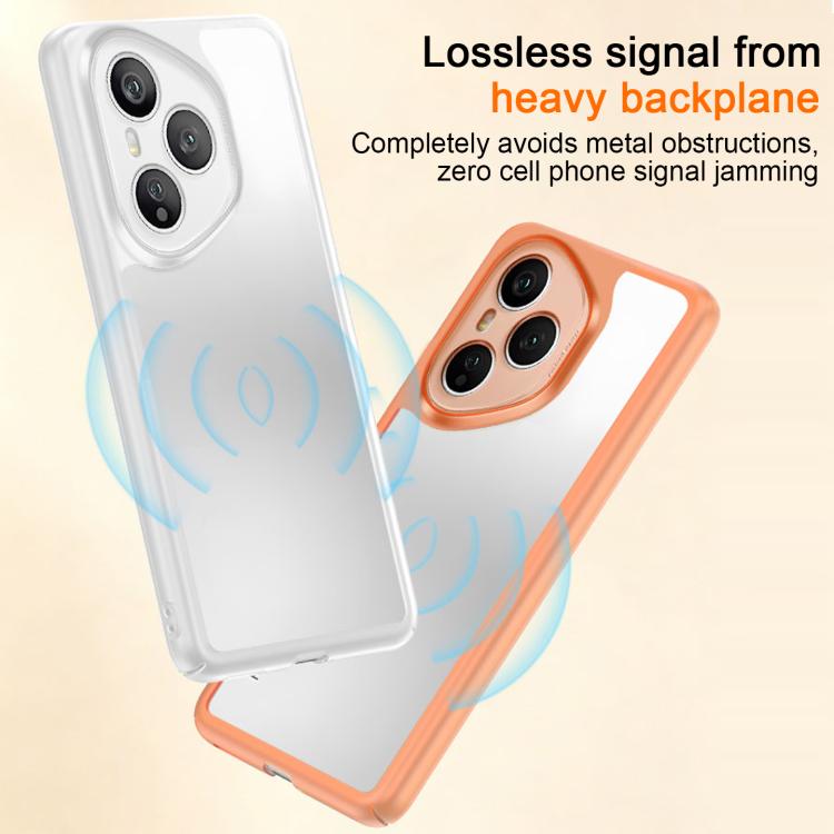 For Honor 400 Pro Global 160.8mm Frosted Slim Heat Dissipation Frame Shockproof PC Phone Case