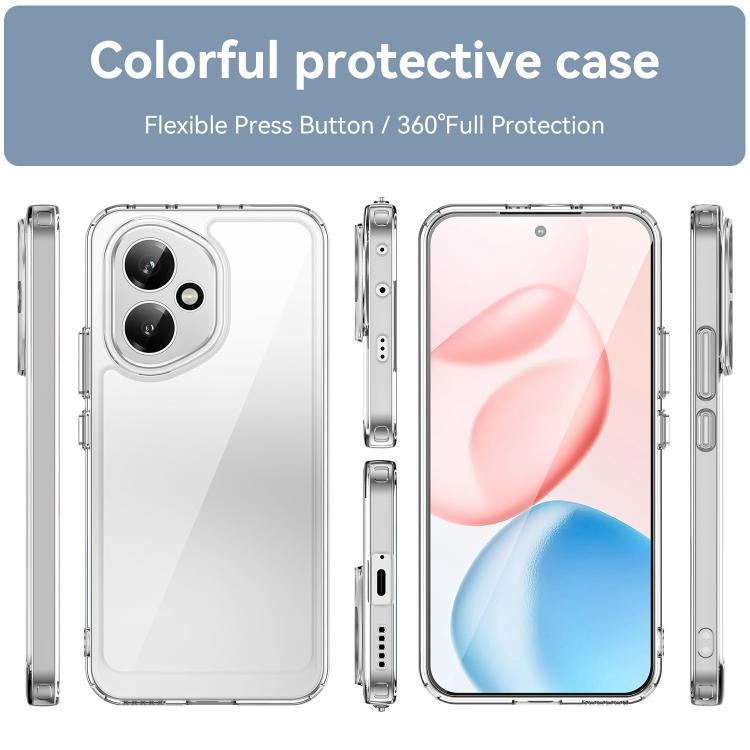 For Honor 400 Global 156.5mm WANLONFENG Electroplated Buttons TPU Acrylic Phone Case with Screen Protector