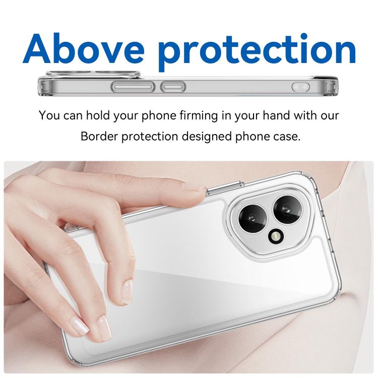 For Honor 400 Global 156.5mm WANLONFENG Electroplated Buttons TPU Acrylic Phone Case with Screen Protector