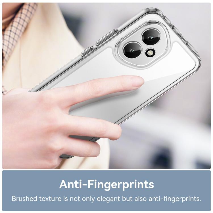 For Honor 400 Global 156.5mm WANLONFENG Electroplated Buttons TPU Acrylic Phone Case with Screen Protector