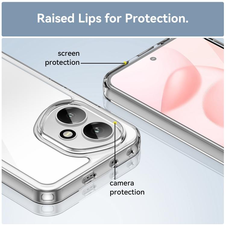 For Honor 400 Global 156.5mm WANLONFENG Electroplated Buttons TPU Acrylic Phone Case with Screen Protector
