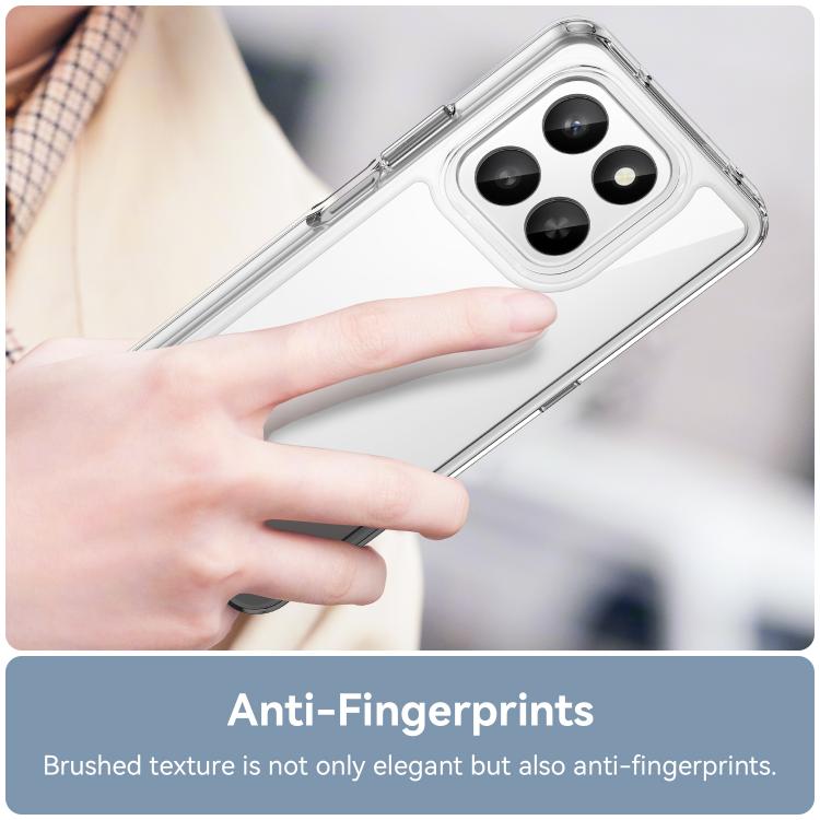 For Honor 400 Smart 5G / 4G / X7d WANLONFENG Electroplated Buttons TPU Acrylic Phone Case with Screen Protector