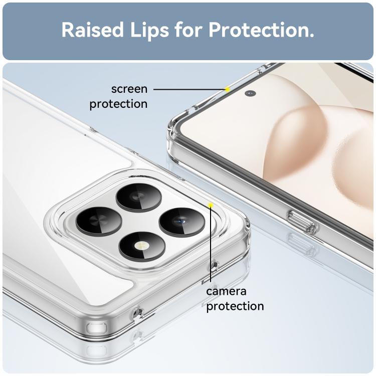 For Honor 400 Smart 5G / 4G / X7d WANLONFENG Electroplated Buttons TPU Acrylic Phone Case with Screen Protector