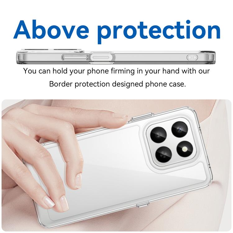 For Honor 400 Smart 5G / 4G / X7d WANLONFENG Electroplated Buttons TPU Acrylic Phone Case with Screen Protector